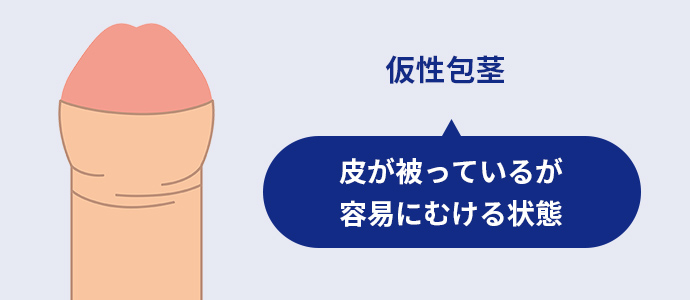 仮性包茎　イメージイラスト
